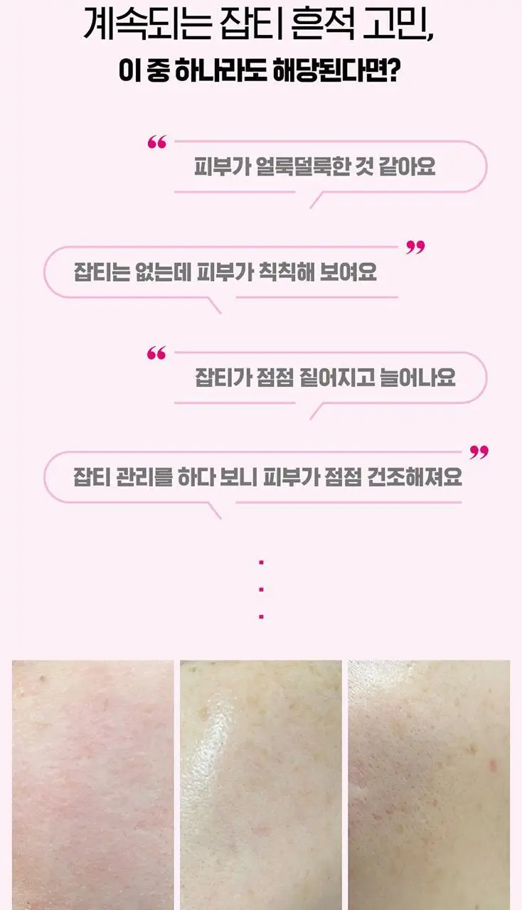 [잡티흔적/로즈PDRN] 아이소이 브라이트닝 잡티케어 듀오 세트(세럼 20ml +크림 35ml) 상세페이지 34